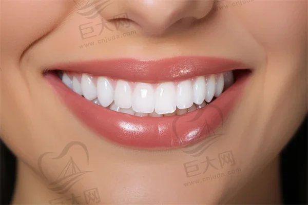 贵阳正规的牙齿瓷贴面医院top10排名
