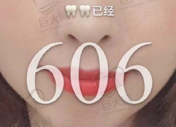 北京中诺口腔时代天使隐形矫正，606天牙齿矫正变化