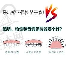 牙齿矫正保持器戴多长时间?透明、哈雷和舌侧保持器哪个好