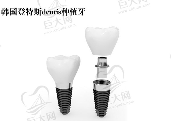 韩国登特斯dentis种植牙怎么样？登特斯和奥齿泰哪个好？