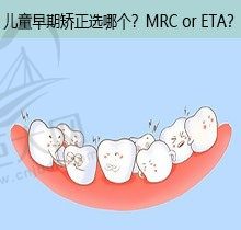 儿童早期牙齿矫正是ETA矫治器好还是MRC好，一键教你咋选
