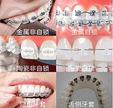 分享重庆牙齿矫正医生推荐名单，想整牙不踩坑的速来参考！