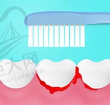 牙龈炎与牙周炎的根本区别是什么？该怎么自测到底有没有牙周炎？