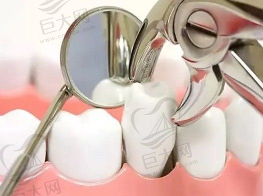做牙齿矫正不想拔牙怎么办？有什么办法可以不拔牙正畸吗？