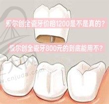 爱尔创全瓷牙价格1200是不是真的？爱尔创全瓷牙800元的到底能用不