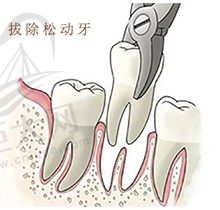 牙齿松动有什么办法恢复呢？牙齿松动了是拔掉好还是留着好