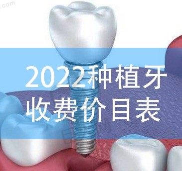 刚更新的2022种植牙收费价目表,曝光2022种植牙齿多少钱一颗？