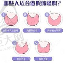 杭州隆胸技术有推荐吗？安排上这几家医院正规还有医生介绍哦