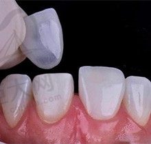 牙齿贴面可以让牙齿变整齐吗？如果做过牙齿贴面还能矫正吗？