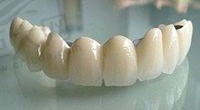为什么做完全瓷牙还是牙疼？想知道全瓷牙有什么危害吗？
