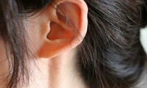 招风耳科普：招风耳整形一般多少钱？儿童招风耳几岁做矫正最好？