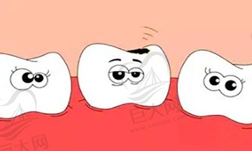 有蛀牙还能矫正牙齿吗？蛀牙带上牙套一段时间后又开始疼是怎么回事
