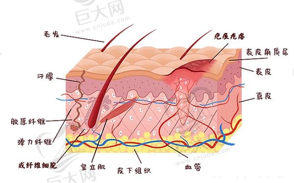 贵阳华医疤痕科祛疤技术好