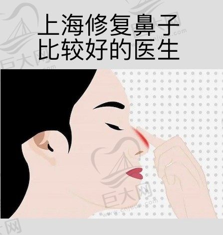 上海修复鼻子比较好的医生排名，看上海鼻修复哪个医生做得好