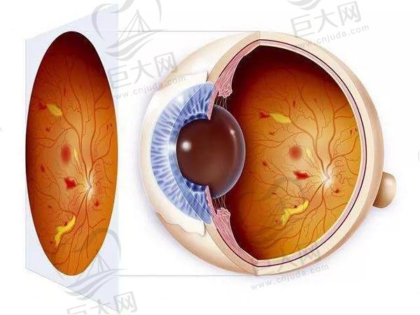 眼科常见的疾病有哪些？综合分析眼科常见的十大疾病及治疗