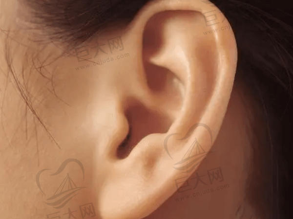 小耳畸形会隔代遗传吗?目前耳朵畸形国家有免费治疗政策吗