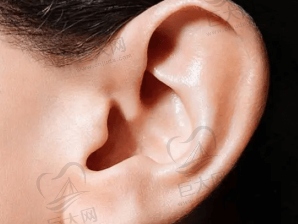 耳再造生物支架能用多久？使用生物材料造耳有哪些优缺点