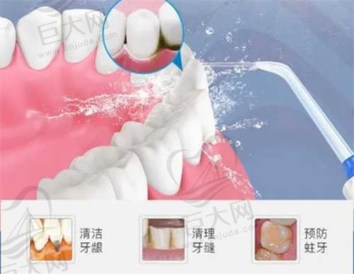 杭州艺星口腔的洪超医生做隐形矫正靠谱吗？价格7000元起