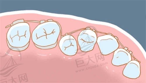 哈尔滨团圆口腔医院地址在哪里？在南岗区做种植牙/牙齿矫正都不错