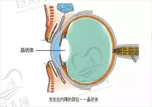 常州谱瑞眼科医院白内障手术多少钱？根据病情3000-15000不等，收费合理