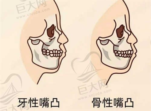 福州领跑口腔医院怎么样？看口碑评价、看实力，让您安心变美