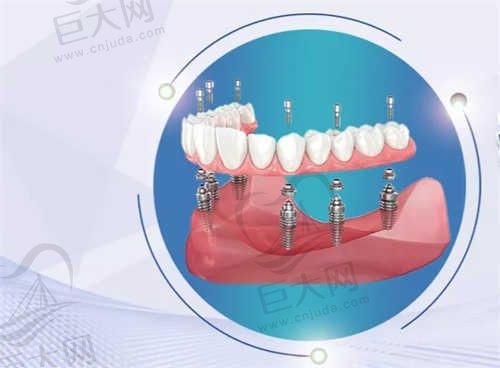 石家庄冀城口腔医院怎么样？口碑好、技术不错，看看患者怎么说！