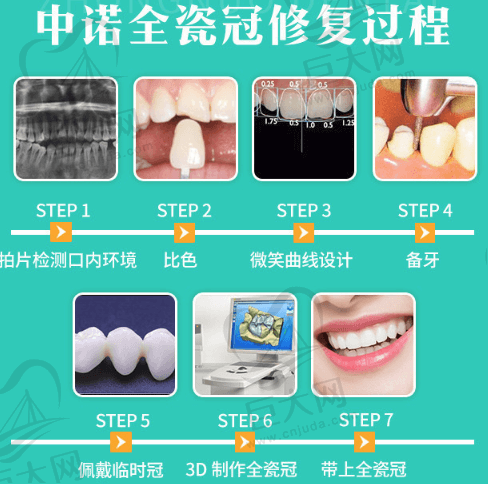 中诺口腔全瓷冠修复过程