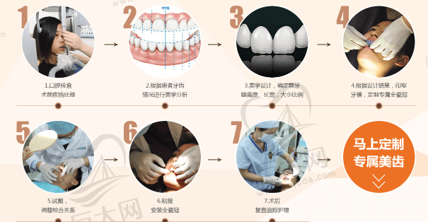 定制专属美齿流程