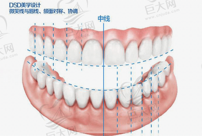 拜博口腔DSD微笑美学设计