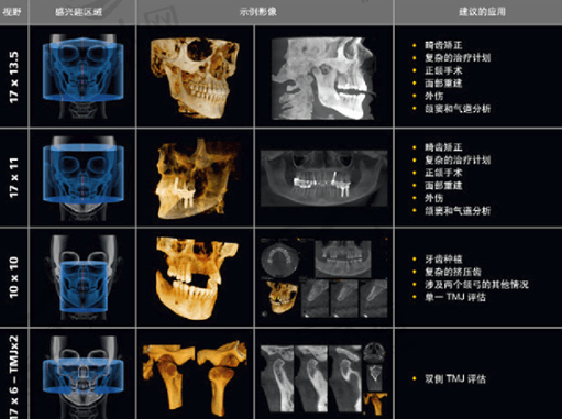 数字成像系统