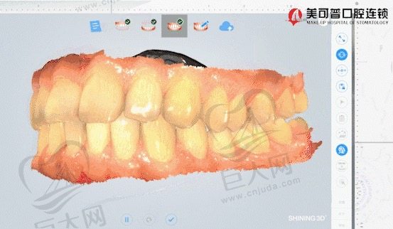 美可普口腔数字化正畸