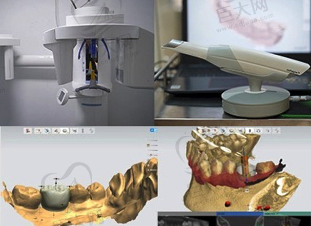 深圳福华口腔医院数字化种植技术