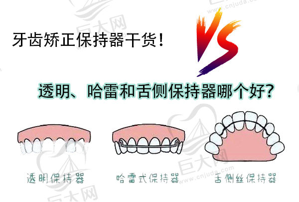 透明、哈雷和舌侧保持器哪个好