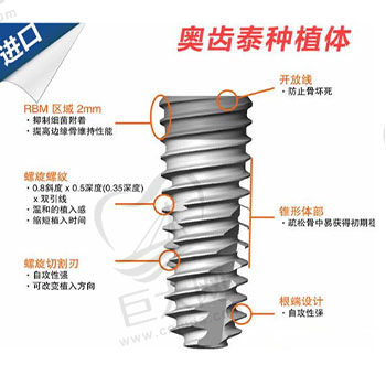 韩国奥齿泰osstem 种植体