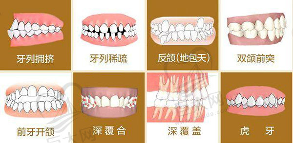 18岁后：恒牙期，牙齿矫正没有时间限制