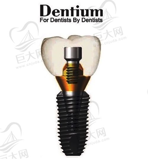 韩国登腾种植系统（Dentium）