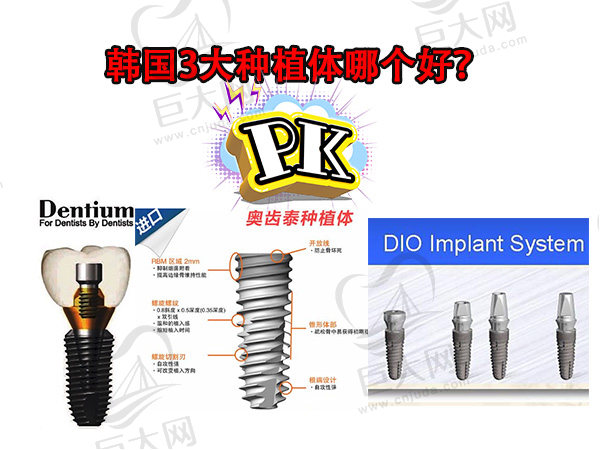韩国种植牙品牌中排名前三