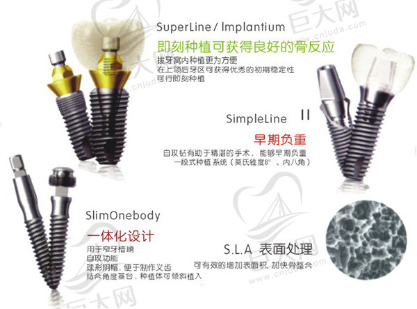 韩国登腾种植牙详细介绍