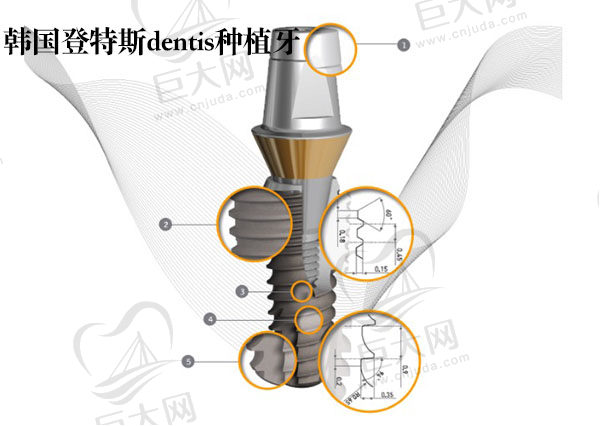 韩国登特斯dentis种植牙