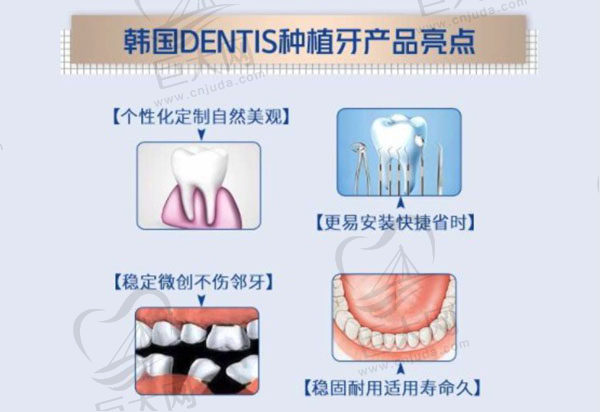 韩国登特斯dentis种植牙优势