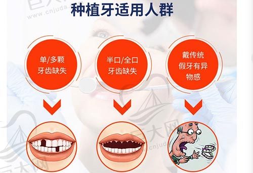 长沙利尔口腔门诊种植牙