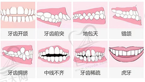 牙齿情况