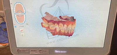 西安高新赛德阳光口腔门诊部iTero口扫仪