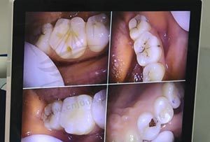 黄岛优美口腔门诊部