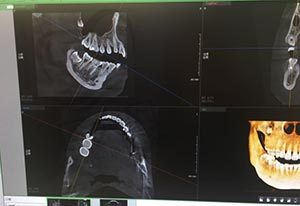 临沂瑞丽口腔牙片