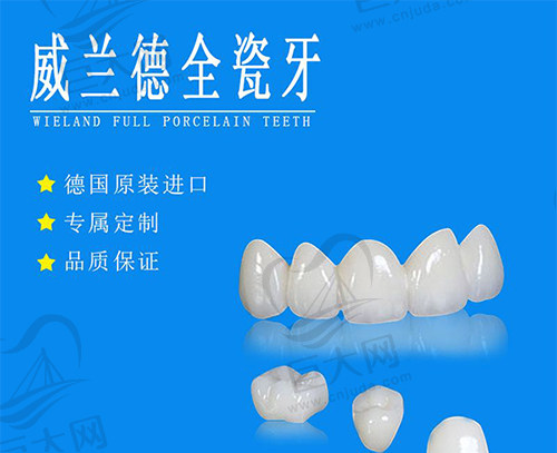 威兰德全瓷牙1600元是真的吗