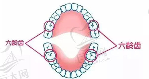 六龄齿