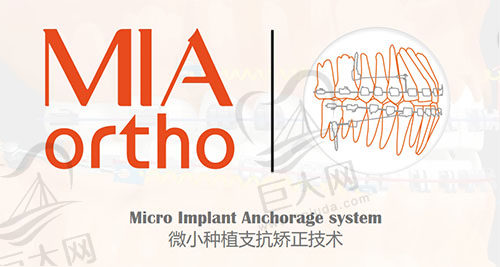 北京庆北米亚口腔微小种植支抗矫正技术