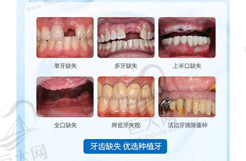 种植适合人群