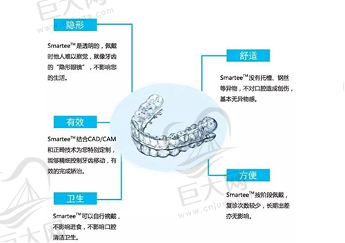 正雅隐形矫正优势